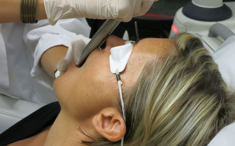 fotona-lasers-treatment-min