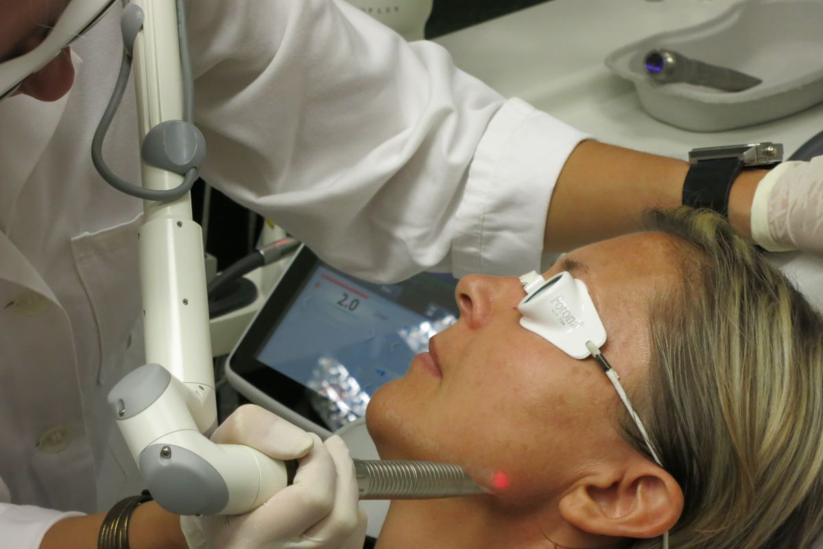fotona-lasers-treatment-on-side-of-face-min