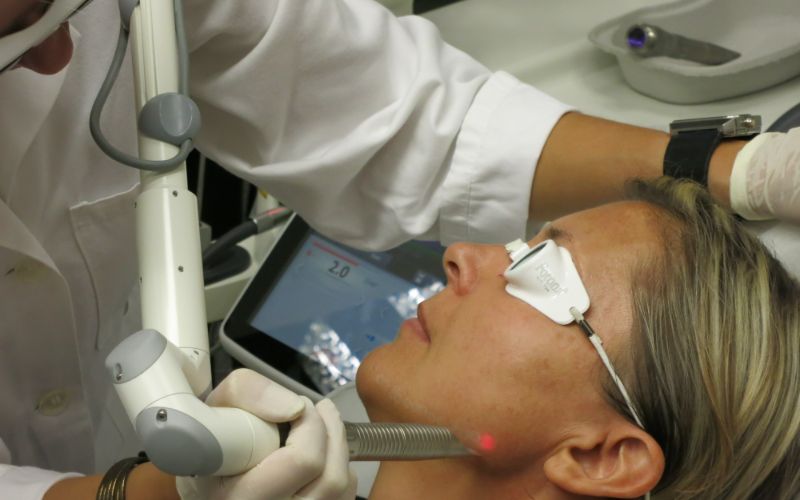 aesthetic lasers south africa treatment-min