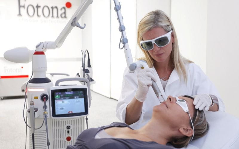 fotona-laser-procedure