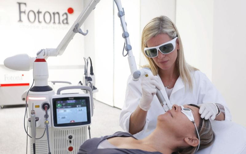 fotona-laser-procedure